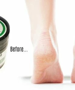 TVTimeDirect Health & Beauty Advanced Clinicals Intensive Dry Foot Exfoliator Peppermint Scrub- 1 Fl. Oz