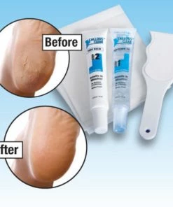 TVTimeDirect Health & Beauty Callous Clear Foot Treatment Kit Deluxe