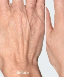 TVTimeDirect Ageless Hands Intensive Therapy By Biologic Solutions (2 Fl Oz) Health & Beauty