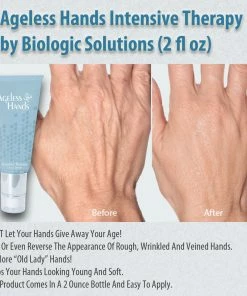 TVTimeDirect Ageless Hands Intensive Therapy By Biologic Solutions (2 Fl Oz) Health & Beauty