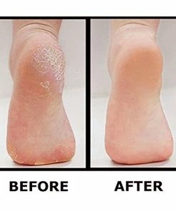 TVTimeDirect Best Pedicure Foot File - Professional Foot Callus Scrubber Health & Beauty