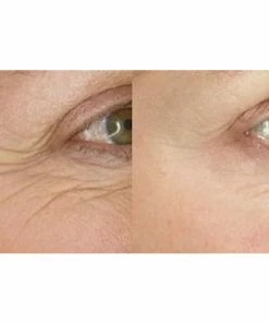 TVTimeDirect Health & Beauty Sta-tight By BioLogic Solutions, 0.5 Oz.