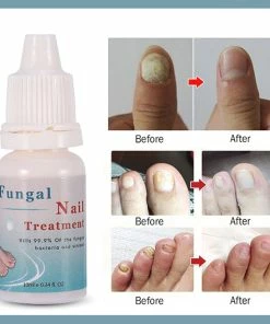 TVTimeDirect Health & Beauty Bright Nail Repair Toenail Fungus Treatment, 10 ML