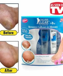 TVTimeDirect Callous Clear Foot Treatment Kit - Removes Calluses In Minutes