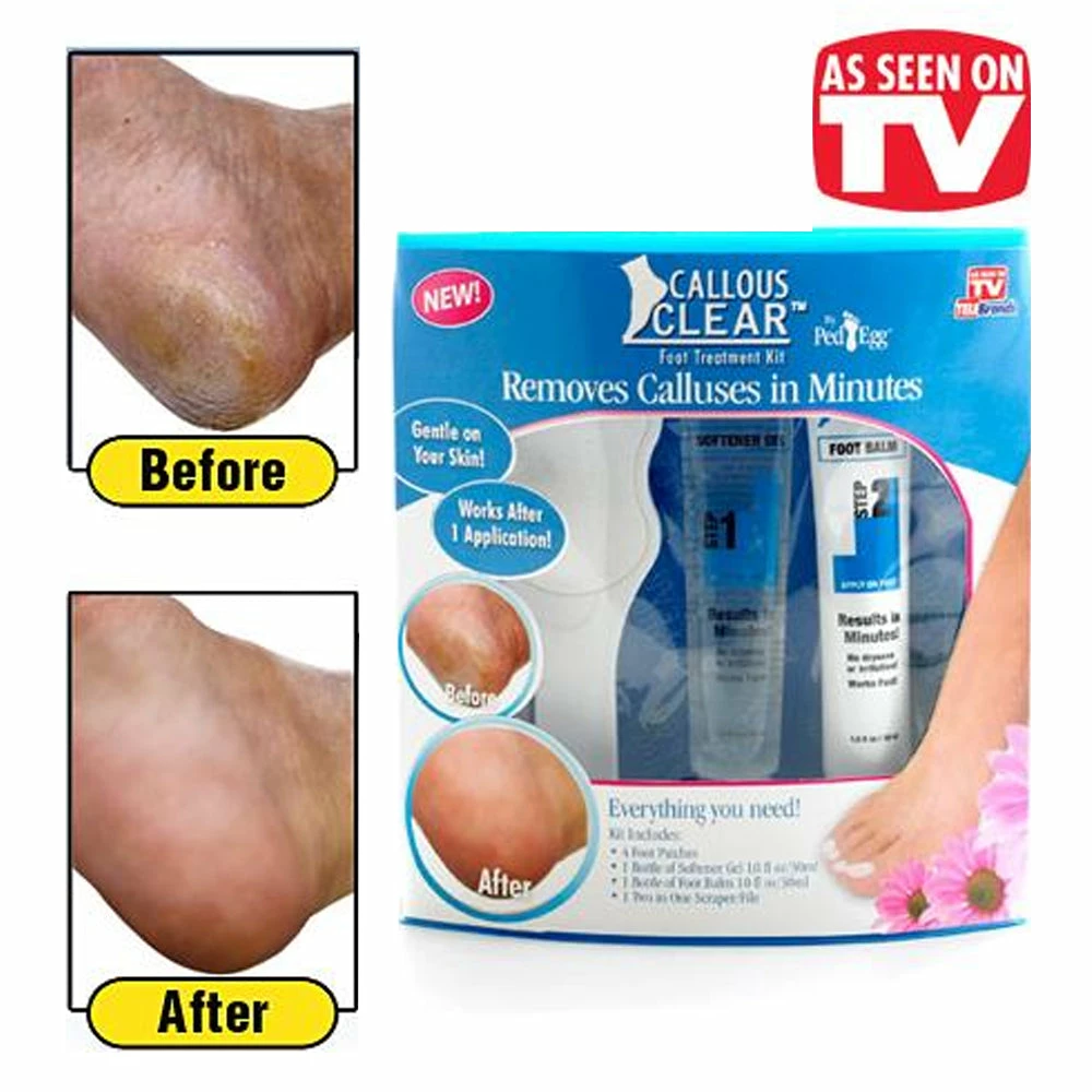 TVTimeDirect Callous Clear Foot Treatment Kit - Removes Calluses In Minutes 4 TVTimeDirect Callous Clear Foot Treatment Kit - Removes Calluses In Minutes