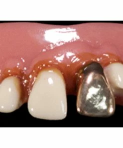 TVTimeDirect The Original Billy-Bob Big Cletus Novelty Teeth Toys & Games