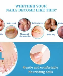 TVTimeDirect Lanthome Nail Repair