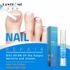 TVTimeDirect Lanthome Nail Repair